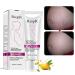 Ofanyia Stretch Mark Removal Cream Repair Scars Stretch Marks Remove Pregnancy Scar Cream