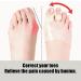 Orthopedic Ballen Toe Corrector - Silicone Smoothing Sleeves for Hammer Toe Chicken Eyes & Toenail Relief | International Shipping Available - Buy Online on SooperMarket.com