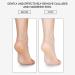 Layhou Foot File Foot Scrubber Callus Remover for Feet Foot Rasp foot file and Callus remover(Metal Foot File) - Buy Online on SooperMarket.com