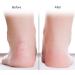 TYCIONG 1 Pair Silicone Socks Foot Protector Anti Tear Protection Foot Care Tool Prevention Socks (M) White M - Buy Online on SooperMarket.com
