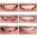 2 Pairs Veneers Dentures - Temporary Tooth Repair for Imperfect Teeth - Buy Online on SooperMarket.com