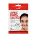 Epielle Acne Clear Patch - Hydrocolloid Pimple Patch for Face & Skin, 4 Pack Acne Spot Treatment Stickers - Cruelty-Free, Two Patch Sizes 8mm & 10mm - Buy Online on SooperMarket.com