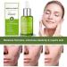 Goopgen Advanced Scar Repair Serum 30ML - Nature Scar Treatment - Scar Removal Serum for All Types of Scars (1PC) - Buy Online on SooperMarket.com
