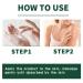 Vitiligo Treatment Cream | Natural White Spot Remover | Leukoplakia Relief | 2PCS - Buy Online on SooperMarket.com