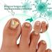 Nail Fungus Removal Liquid - Natural Toenail Fungus Oil for Effective Nail Care | BTSEURY - Buy Online on SooperMarket.com