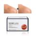 Scar Removal Cream | Smoothing Skin & Reduce Formation of Connective Tissue | Repair Cream for Burn & Old Scars | Easy to Use - Buy Online on SooperMarket.com