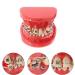 Orthodontic Braces Model Doll-10 - Ceramic Teeth Study for Adults | Ideal for Medical Science & Teaching Research - Buy Online on SooperMarket.com
