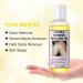Dark Skin Peeling Oil and Dark Spot Correcting Cream - Extra Strength Exfoliating Solution - Buy Online on SooperMarket.com
