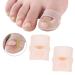 Paronychie Treatment Corrector - Pain Relief Silicone Ingrown Toenail Fix for Women | Durable & Heat Resistant - Buy Online on SooperMarket.com