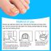 Ingrown Toenail Correction Foot Care Pedicure Sticker Corrector Ingrown Patch Relief Toe Patch Treatment Tool60pcs (60 Pieces) - Buy Online on SooperMarket.com