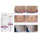 RtopR Mango Stretch Marks & Scar Cream - Pregnancy Safe Moisturizer - 80g (Pack of 2) - Buy Online on SooperMarket.com