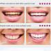 1/2Pcs CrystalClean Smile Powder MediLisk Mint Tooth Powder The New Teeth Whitening Solution Get White Teeth in 7 Days (1PCS) - Buy Online on SooperMarket.com