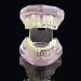 LBYLYH Orthodontic Demonstration Model - Teeth Teaching Tools with Metal & Ceramic Support for Effective Dental Treatment - Buy Online on SooperMarket.com