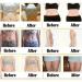 Mugwort Belly Button Patch (60PCS) - Natural Plant for Men and Women - White - Buy Online on SooperMarket.com