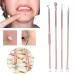 pimple extractor 4PCS/SET Blackhead Removal Tool Pimple Cleansing Tool Kit Stainless Steel Acne Pimple Extractor Acne Remover Tool With Box(Rose Gold) - Buy Online on SooperMarket.com
