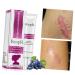 PLAFOPE Scar Cream - Scar Eraser & Remover for Face, Stretch Marks, Skin Repair - 1pc - Buy Online on SooperMarket.com