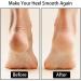Moisturizing Toeless Silicone Socks for Women - 6pcs | Dry Cracked Heel Treatment - Buy Online on SooperMarket.com