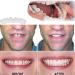 LAMILL DIY Dentures Teeth Veneers for Men and Women - Elastic Tooth Cover - Perfect Smile Solution (2 PCS) - Buy Online on SooperMarket.com