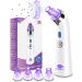 Blackhead Remover  POPPYO Blackhead Vacuum  Electric Facial Vacuum Cleaner  Pore Vacuum Extractor Tool  Comedo Removal Beauty Suction Device for Women(Purple)