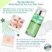 Bye Bye Blemish Witch Hazel + Tea Tree Blemish Toner - Acne Treatment & Skin Care 4.4 fl oz | International Shipping Available - Buy Online on SooperMarket.com