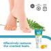 FOOTNESS Cream for Cracked Heels 25% Urea Restores Dry Skin in 7 Days (50 ml) - Buy Online Now! - Buy Online on SooperMarket.com