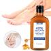 Urea 42% Foot Cream Foot Nourishing Cream For Cracked Heels And Dry Skin Deep Moisturizing Callus Remover For Dry And Hard Skin Feet And Hand Maximum Strength For Hand Foot And Body Care - Buy Online on SooperMarket.com