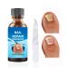 Fungal Nail Treatment 30ML Nail Fungus Serum for Toenail Extra Strong Gentle Anti Fungal Nail Serum Protects Thick Broken Discolored Nails Restoring Healthy Nails For Finger And Toe Nail Fungal