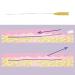 Acada PDO Thread Lift | 20Pcs 29G*38MM Mono Smooth Threads for Face & Body - Buy Online on SooperMarket.com