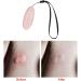 Predolo Sting and Bite Relief Electric Itch Reliever Pen for Kids | Compact Anti-Itch Device for Household, Travel, Camping - Pink - Buy Online on SooperMarket.com