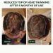 Scandinavian Biolabs Hair Growth System for Men | Clinically Proven Hair Loss Treatment in 45 Days - Buy Online on SooperMarket.com