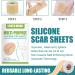Silicone Scar Gel Strip - Efficient Scar Treatment for Surgery, Acne & Trauma - 4 * 150cm - Buy Online on SooperMarket.com