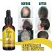 Luxsea Ginger Hair Care Nutrient Solution - Buy Online on SooperMarket.com