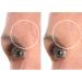 SiO Beauty BrowLift Forehead Anti-Wrinkle Patch - Rapid Overnight Reusable Silicone Patch to Reduce Furrows Expression Lines and Creases - Buy Online on SooperMarket.com