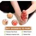 50 Pcs Silicone Anti-Friction Toe Protector Breathable Gel Toe Protector Little Toe Cover Protectors Caps for Men and Women Toe Sleeves with Hole to Protect Toe from Rubbing Corns Blisters etc - Buy Online on SooperMarket.com