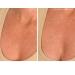SiO Beauty Plunging Neckline - Overnight Silicone Smoothing Patches for Neck & Chest | Reusable SkinPad & Necklift - Shop Now - Buy Online on SooperMarket.com