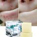 Weixinbuy Mite Soap Rich In Sea Salt Quickly Remove Mites Repair Nourish Skin Personal Care Product - Buy Online on SooperMarket.com