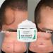 Scar Repair Cream | Acne Scar Removal & Pigmentation Corrector | Stretch Mark Remover | Skin Whitening | Scar Care - Buy Online on SooperMarket.com