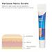 Varicose Veins Cream | Eliminate Spider Veins & Soothing Treatment - International Shipping - Buy Online on SooperMarket.com