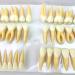 BEAGHTY 2.5x Magnified Tooth Shape Model - 2-Color Dental Structure & Denture Model for Study & Teaching - Buy Online on SooperMarket.com