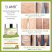 Varicose Veins Treatment Cream 50G - Spider Vein Relief for Tired, Heavy Legs | Strengthen Capillaries, Improve Leg Appearance - Buy Online on SooperMarket.com