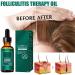 BEALIFE Adults Dense Hair Essential Oil Adults Natural Ingredient Regrowth Anti-loss Moisturizing Essence Haircare - Buy Online on SooperMarket.com