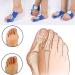 2PCS Toe Straighteners Hallux Valgus Orthotics - Big Toe Corrector for Foot Alignment - Day and Night Guard for Bone Correction - Buy Online on SooperMarket.com