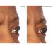 SiO Beauty Mid-Brow Forehead Anti-Wrinkle Patch - Overnight Silicone Patch for Furrows, Expression Lines, and 11s - Buy Online on SooperMarket.com