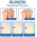Projoint Antibunions Health Sock - StrongJoints & Bunion Pain Relief Socks (5 Pairs, Black) - Buy Online on SooperMarket.com