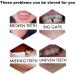 Fake Tooth Repair Kits for Filling The Missing Broken Tooth and Gaps-Moldable Fake Teeth and Thermal Beads Replacement Kits - Buy Online on SooperMarket.com