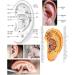 Dong Bang Sterile Ear Acupuncture Disposable Press Patches x 500pcs - Buy Online on SooperMarket.com