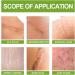 Dajidafu Women Belly Stretch Mark Body Acne Scars Removal Girls Repair Essence Anti-aging Beauty Supplies 30ml - Buy Online on SooperMarket.com