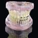 LBYLYH Orthodontic Demonstration Model - Teeth Teaching Tools with Metal & Ceramic Support for Effective Dental Treatment - Buy Online on SooperMarket.com