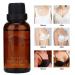 Breast Essential Oil for Hyperplasia Relief | Pain-Relieving 30 ml Care for Mammary Glands - Buy Online on SooperMarket.com