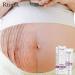 Ofanyia Stretch Mark Removal Cream - Effective Repair for Scars & Pregnancy Marks | International Shipping - Buy Online on SooperMarket.com